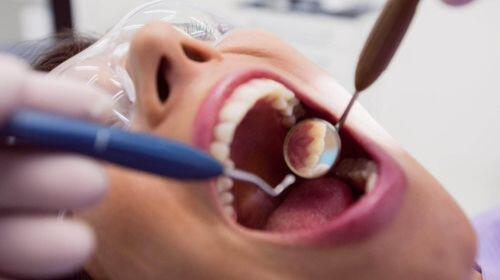 Root Canal Treatment