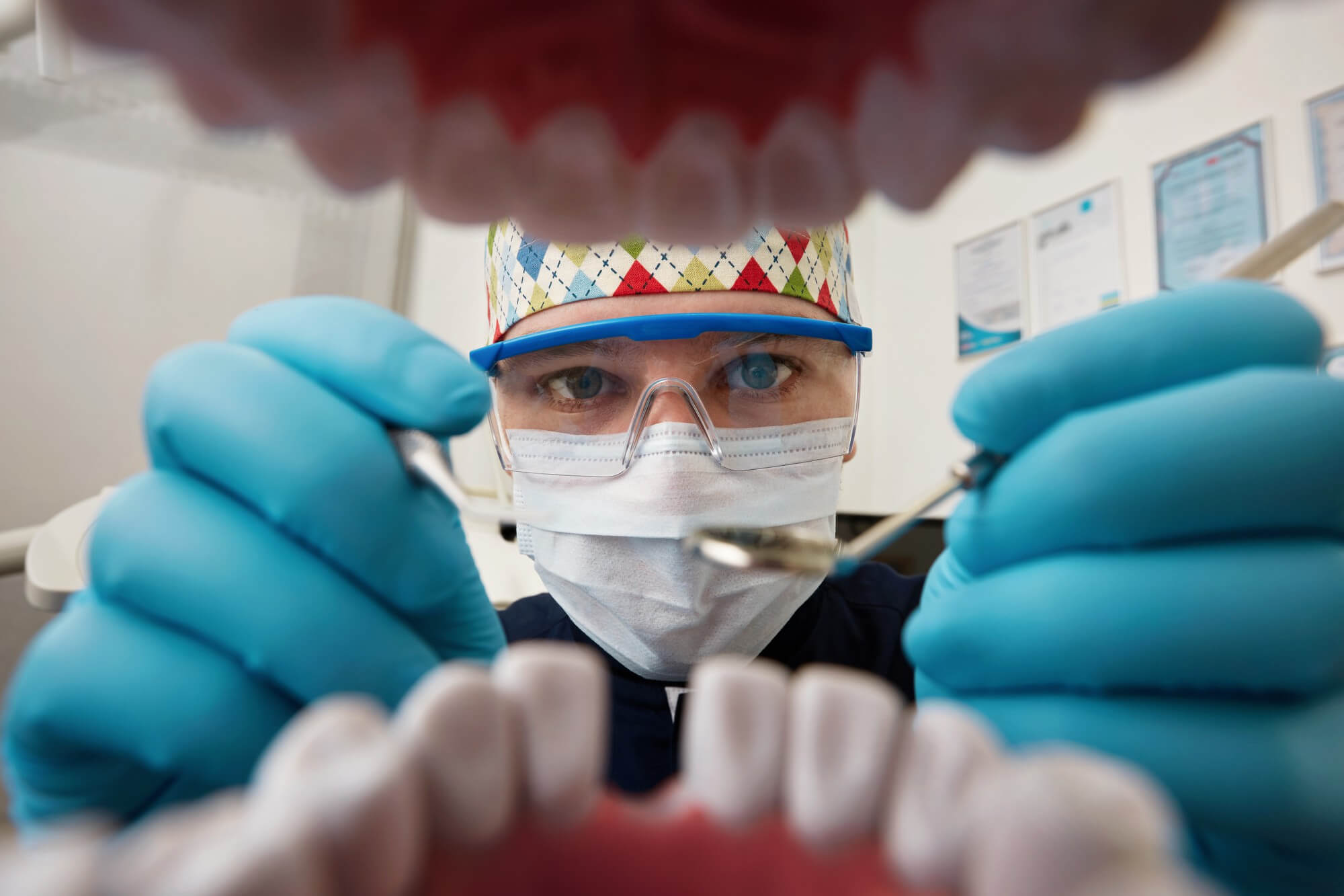Dental veneers treatments at negombo