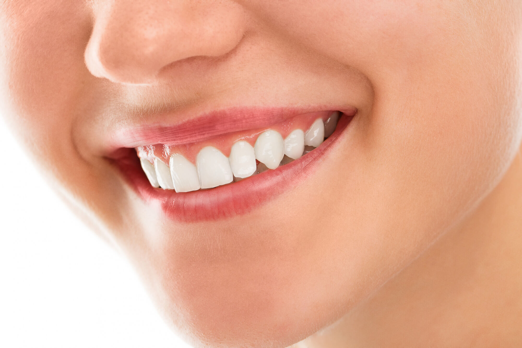 tooth bonding treatment at happy dental care clinics negombo