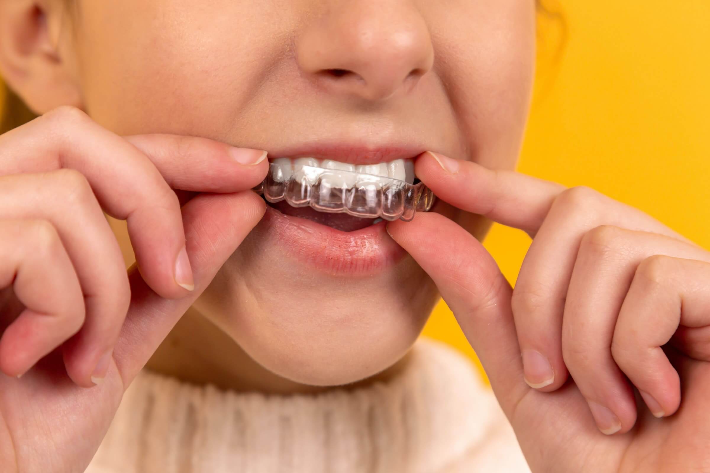 Best place to buy Mouth Guards at negombo